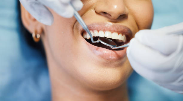 Best Walk-In Emergency Dentist in Mccom, OH
