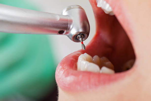 Best Emergency Treatment for Toothache in Mccom, OH